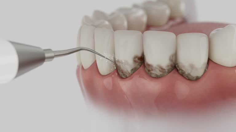 Reliable Dental Implants contractor in Gallatin, MO by Smile Center Dentistry